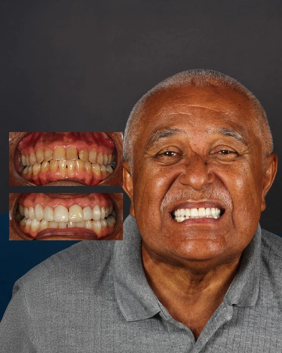 Joa Ramailho, paciente PRÓ-ODONTO — antes e depois do tratamento